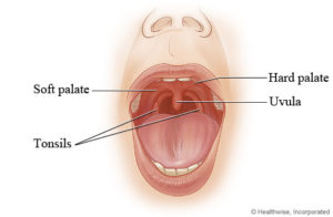 What is snoring?