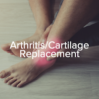 Arthritis/Cartilage Replacement