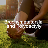 Brachymetatarsia and Polydactyly