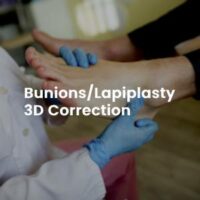 Bunions/Lapiplasty 3D Correction