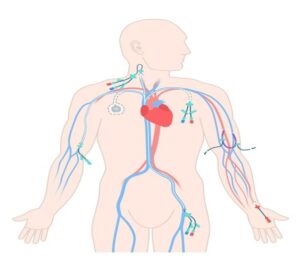 Central Venous Access