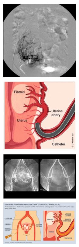  X-ray guidance