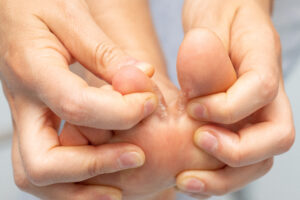 Nail and Skin condition