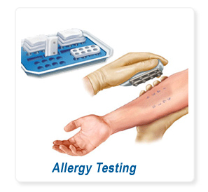 Allergy Testing