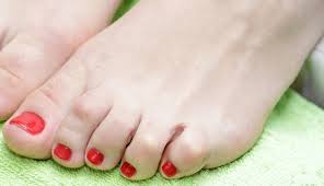 Hammertoes