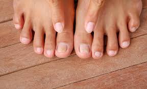 Ingrown Toenails