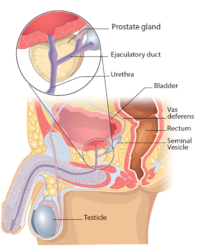 Enlarged Prostate