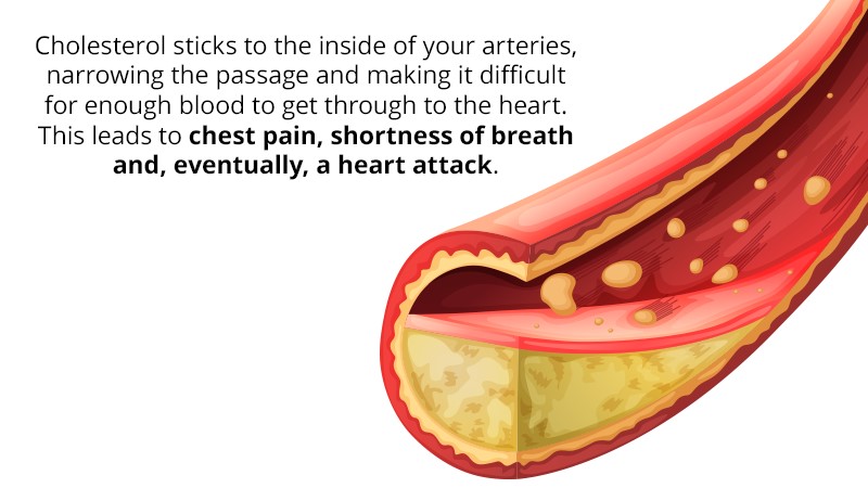 chest-pain