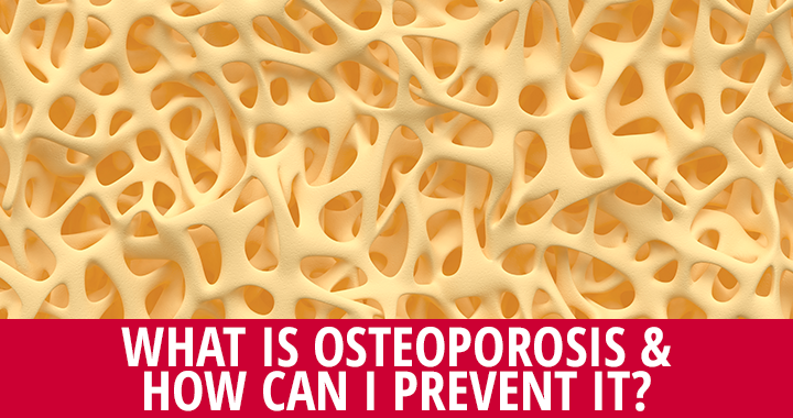 All About Osteoporosis