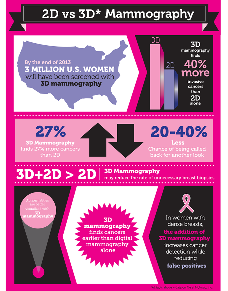 3D Mammography infographic