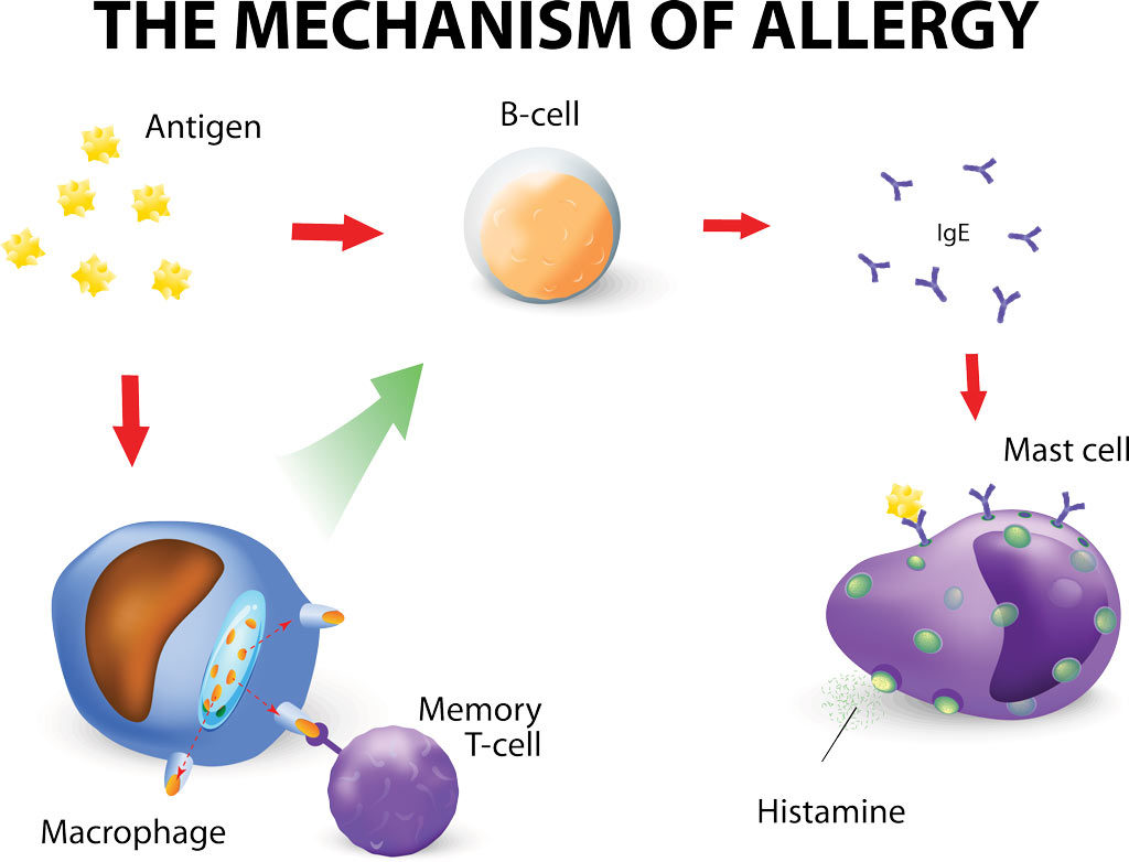 allergy