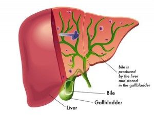 Gallbladder Removal